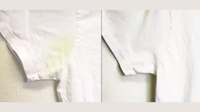 How To Wash White School Shirts